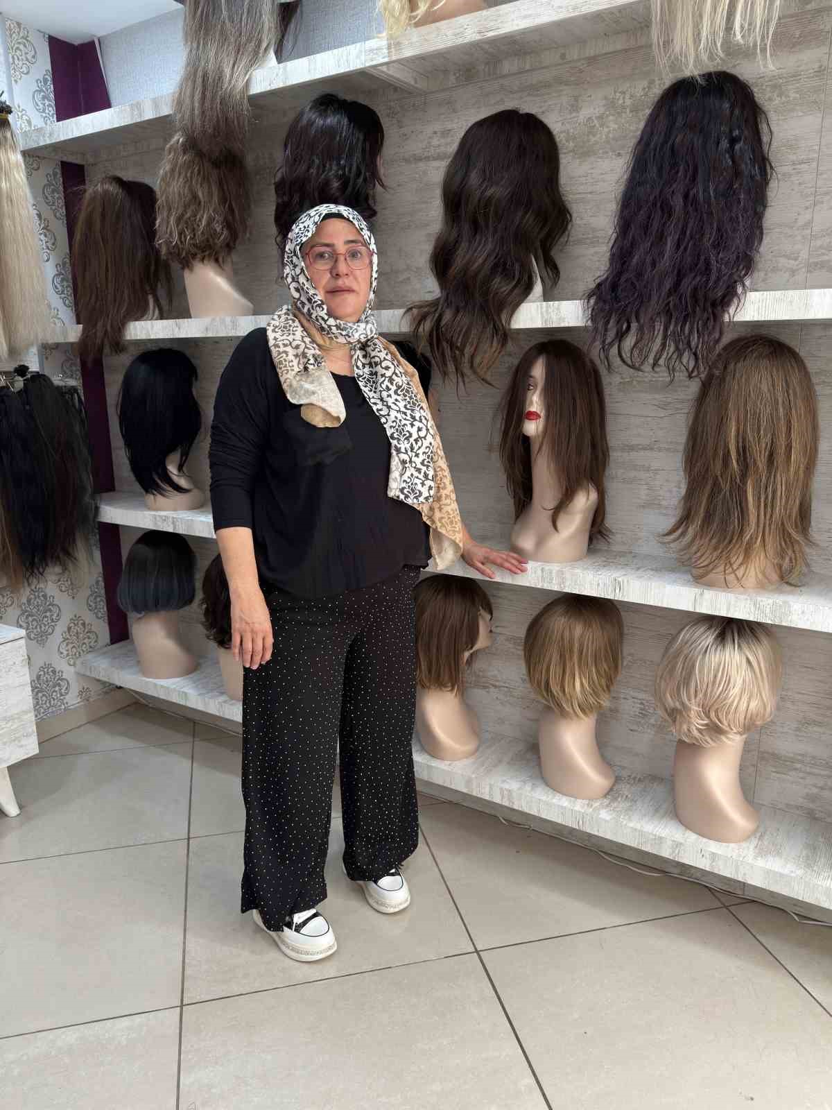 12 yaşında saçlarını ve kulaklarını kaybetti, şimdi kadınlara umut oluyor