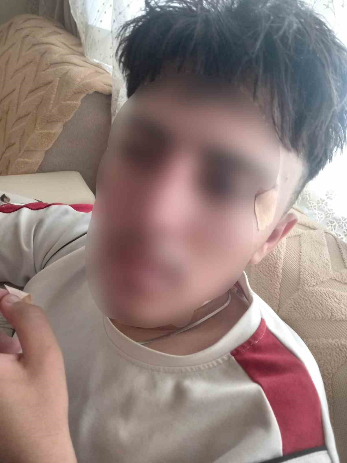 Öğretmenin kafa attığı çocuğun burnu kırıldı
