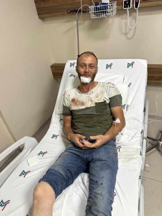 G&uuml;r&uuml;lt&uuml; tartışması sopalı kavgayla bitti: O anlar kamerada