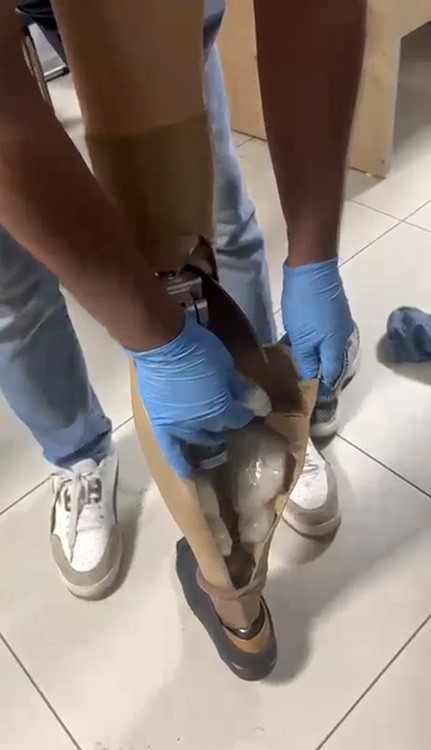 Protez bacağından uyuşturucu &ccedil;ıktı: 830 gram metamfetamin ele ge&ccedil;irildi