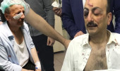 Ankara'da Saadet Partliler ile MHP'liler Arasında Sopalı Kavga Çıktı, Milletvekili Adayı Hastanelik Oldu