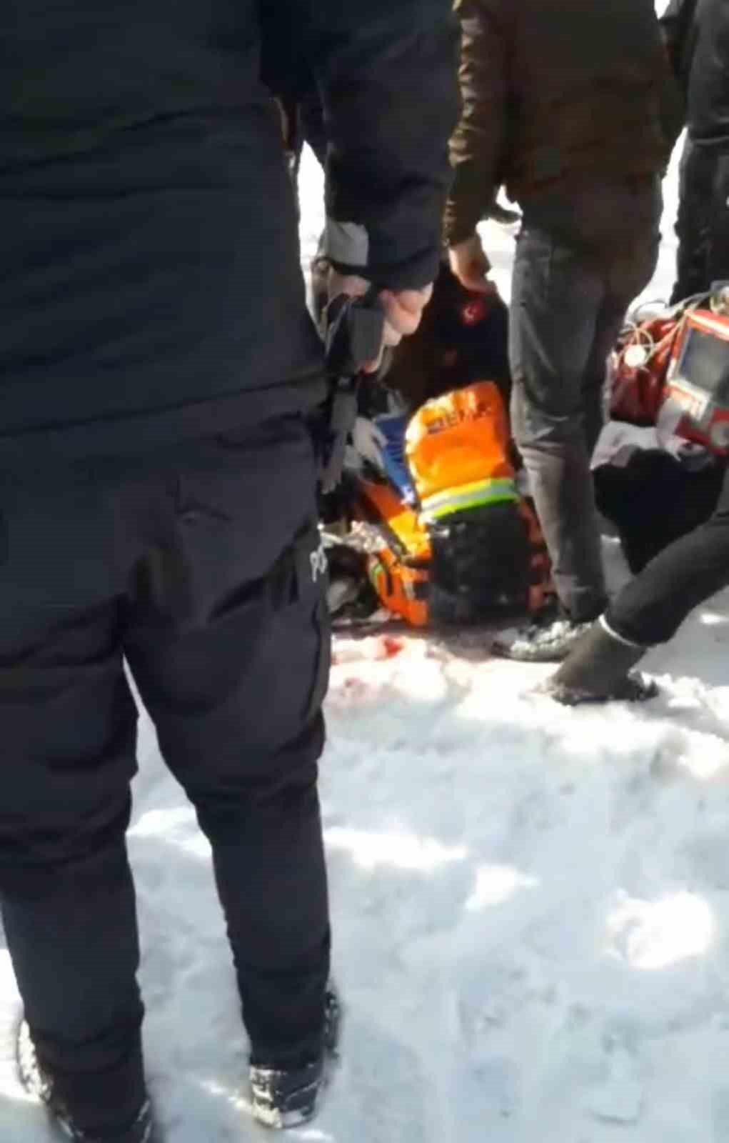 Y&uuml;ksekova&rsquo;da başıboş k&ouml;pekler dehşet sa&ccedil;tı: 12 yaşındaki kız ağır yaralandı
