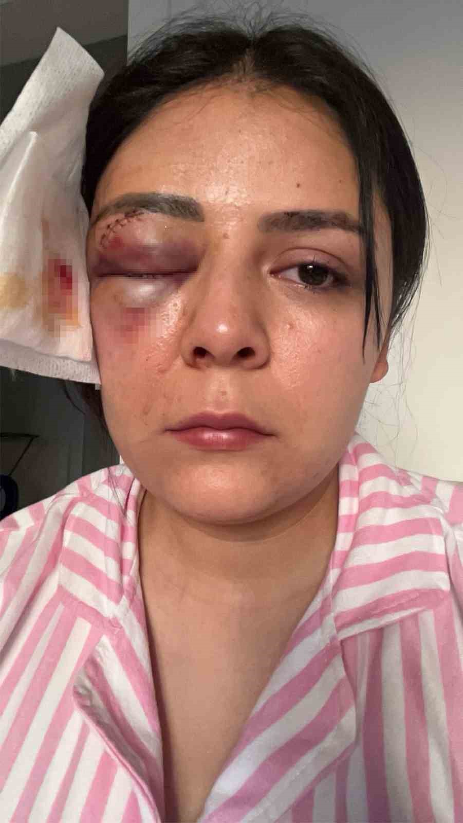 Y&uuml;r&uuml;rken saldırıya uğrayan gen&ccedil; kız konuştu: "Psikolojim alt&uuml;st oldu" 