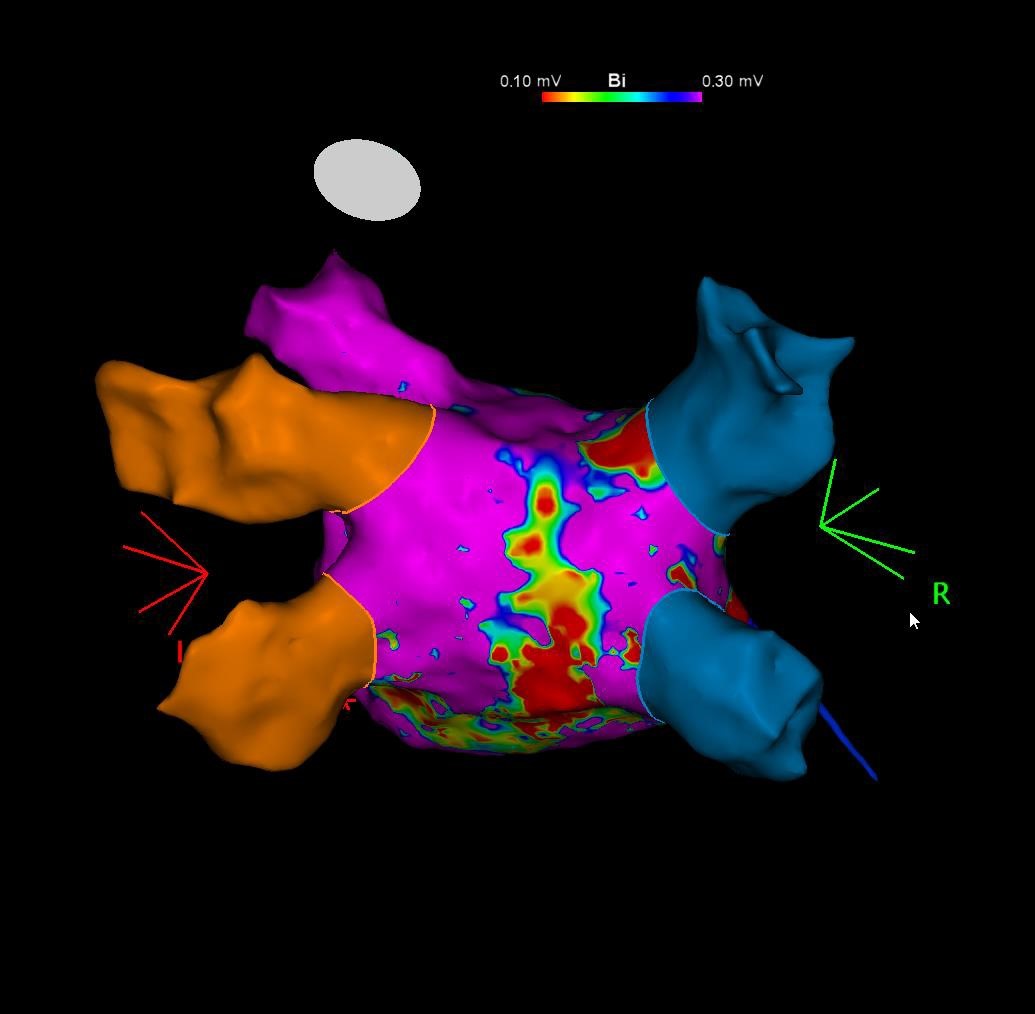 Eskişehir Şehir Hastanesi bir başarıya daha imza attı