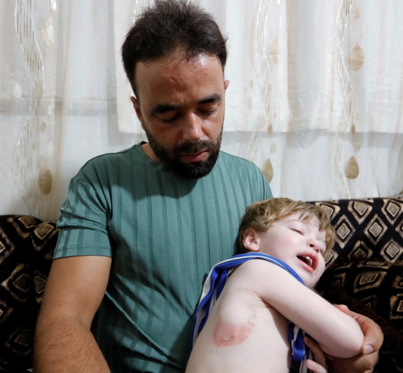 Attan beklenmedik hareket: Babasının kucağındaki çocuğu ısırarak alıp havaya fırlattı