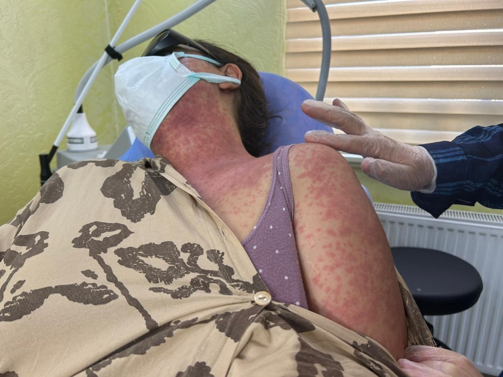 Van’da ‘beyazlatıcı krem’ faciası: 4 kişi hastanelik oldu