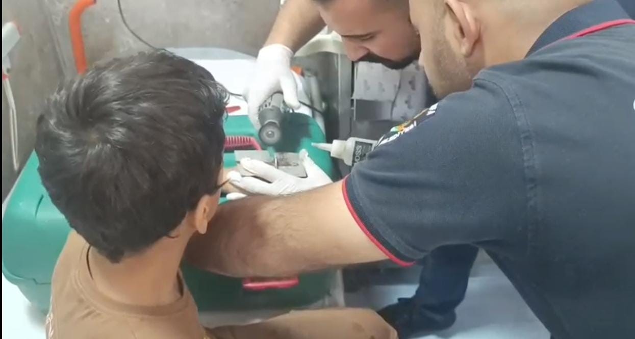 &Ccedil;ocuğun parmağına sıkıştırdığı cıvata pulu kesilerek &ccedil;ıkartıldı
