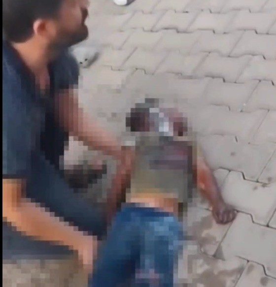 Yangında ağır yaralanan &ccedil;ocuk hayatını kaybetti
