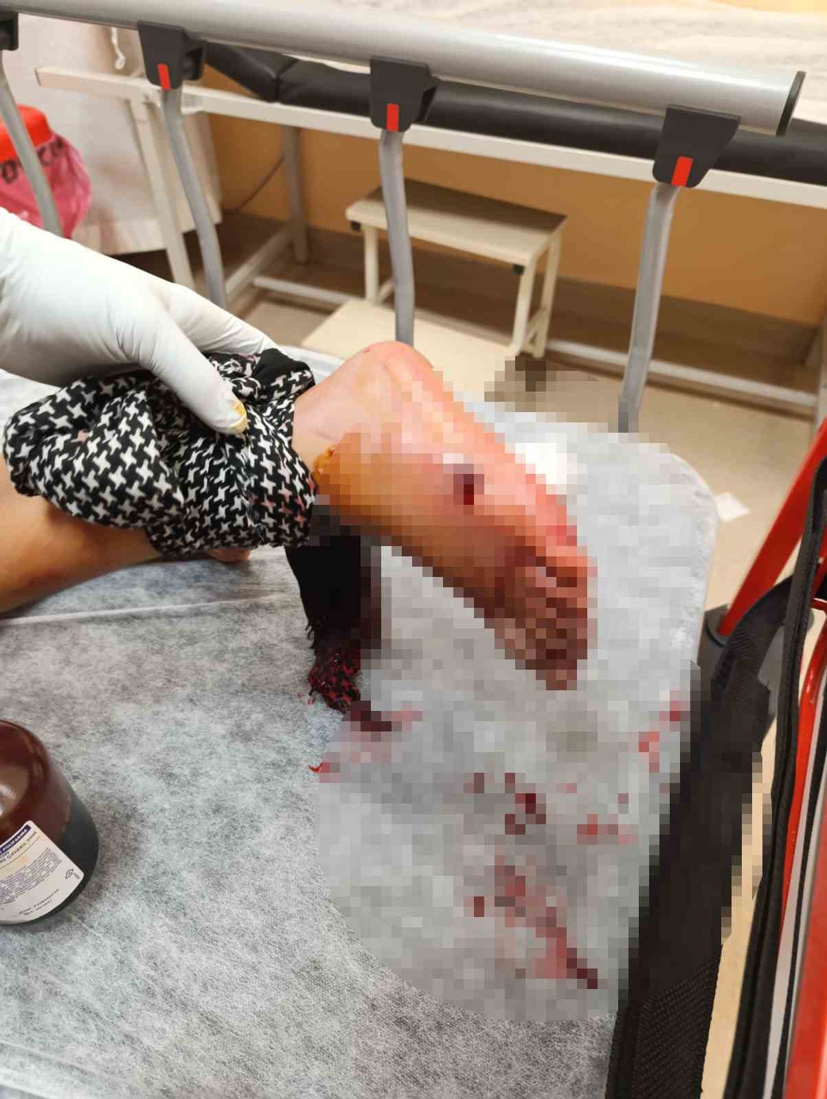 Balkonda oturan &ccedil;ocuğa kurşun isabet etti
