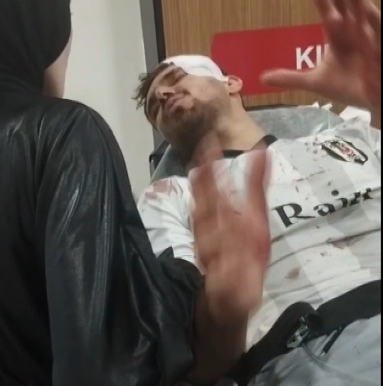 Mahalle ma&ccedil;ı kavgaya d&ouml;n&uuml;şt&uuml;: 2 yaralı
