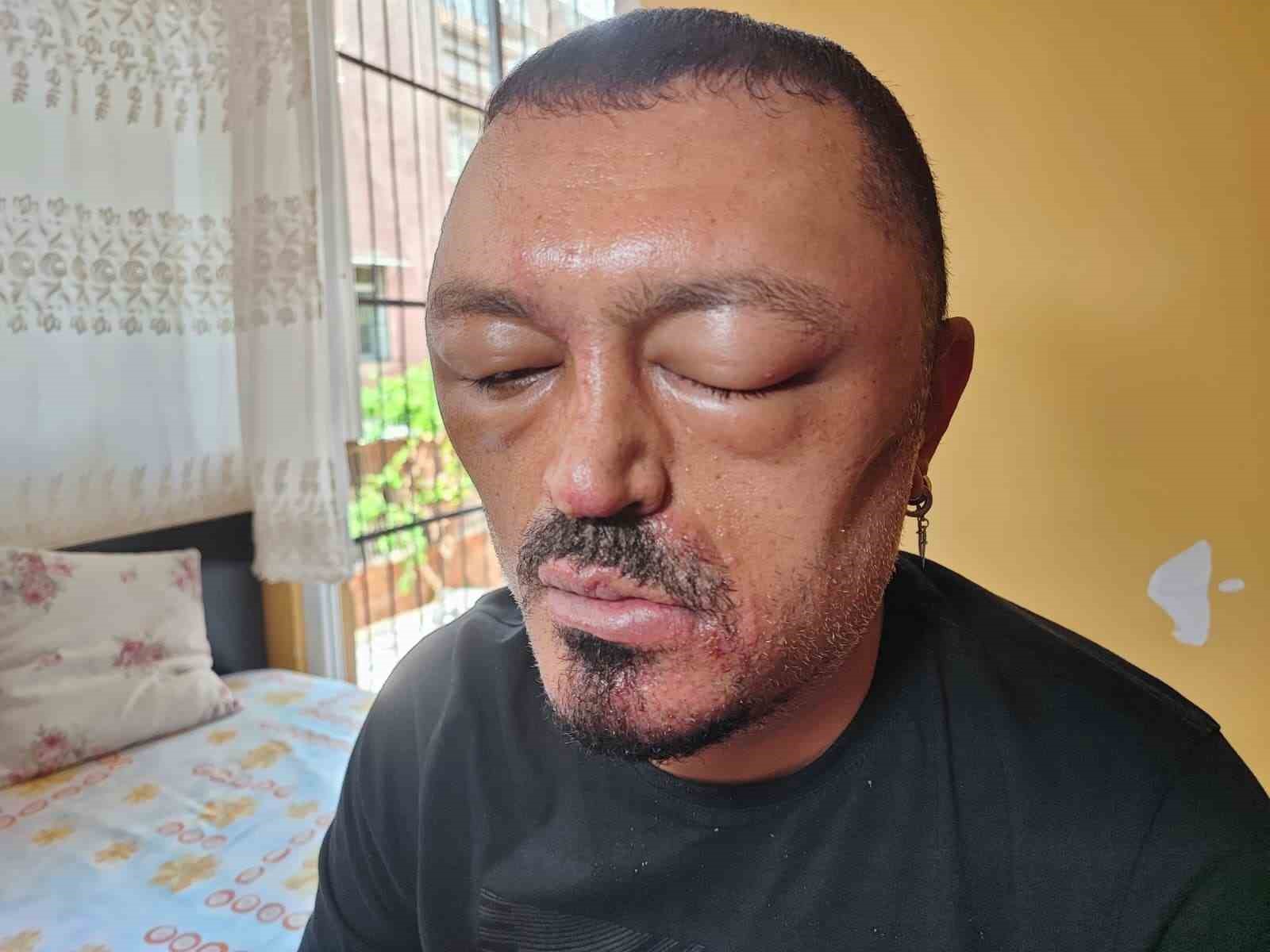 Uzmanı uyardı: "Cilde uygulanacak ürünler mutlaka doktor kontrolünde alınmalı"
