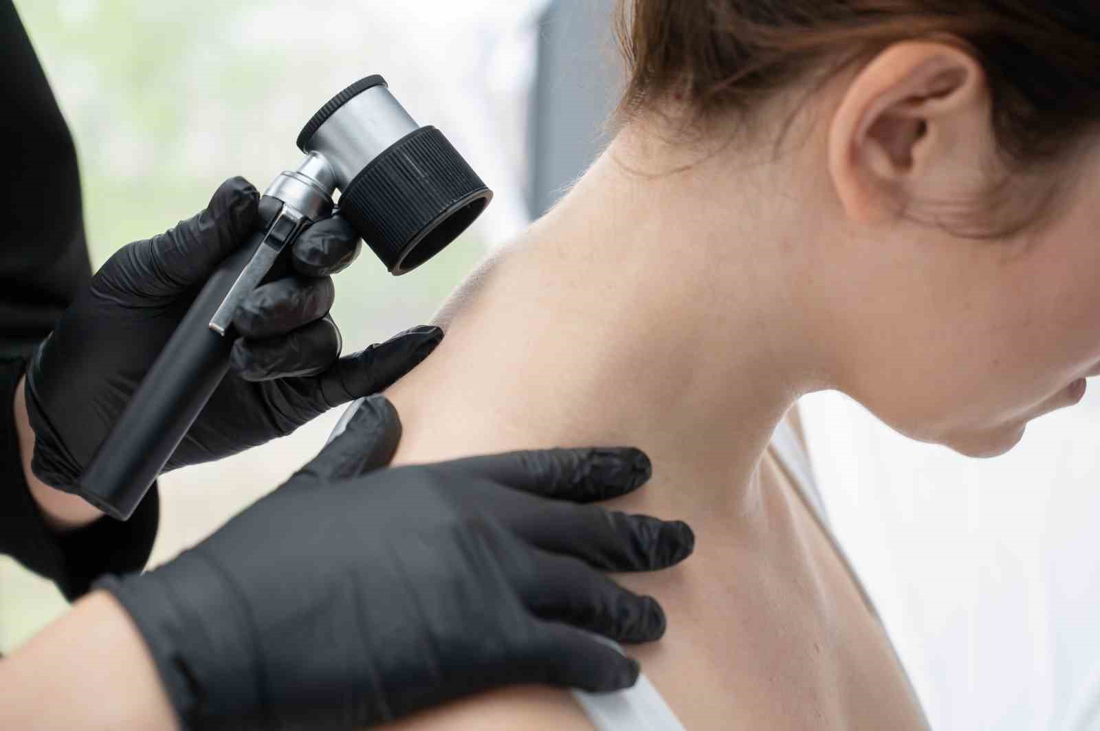 Uzm. Dr. &Ouml;zkapu: "Cilt check-up&rsquo;ınızı ertelemeyin"
