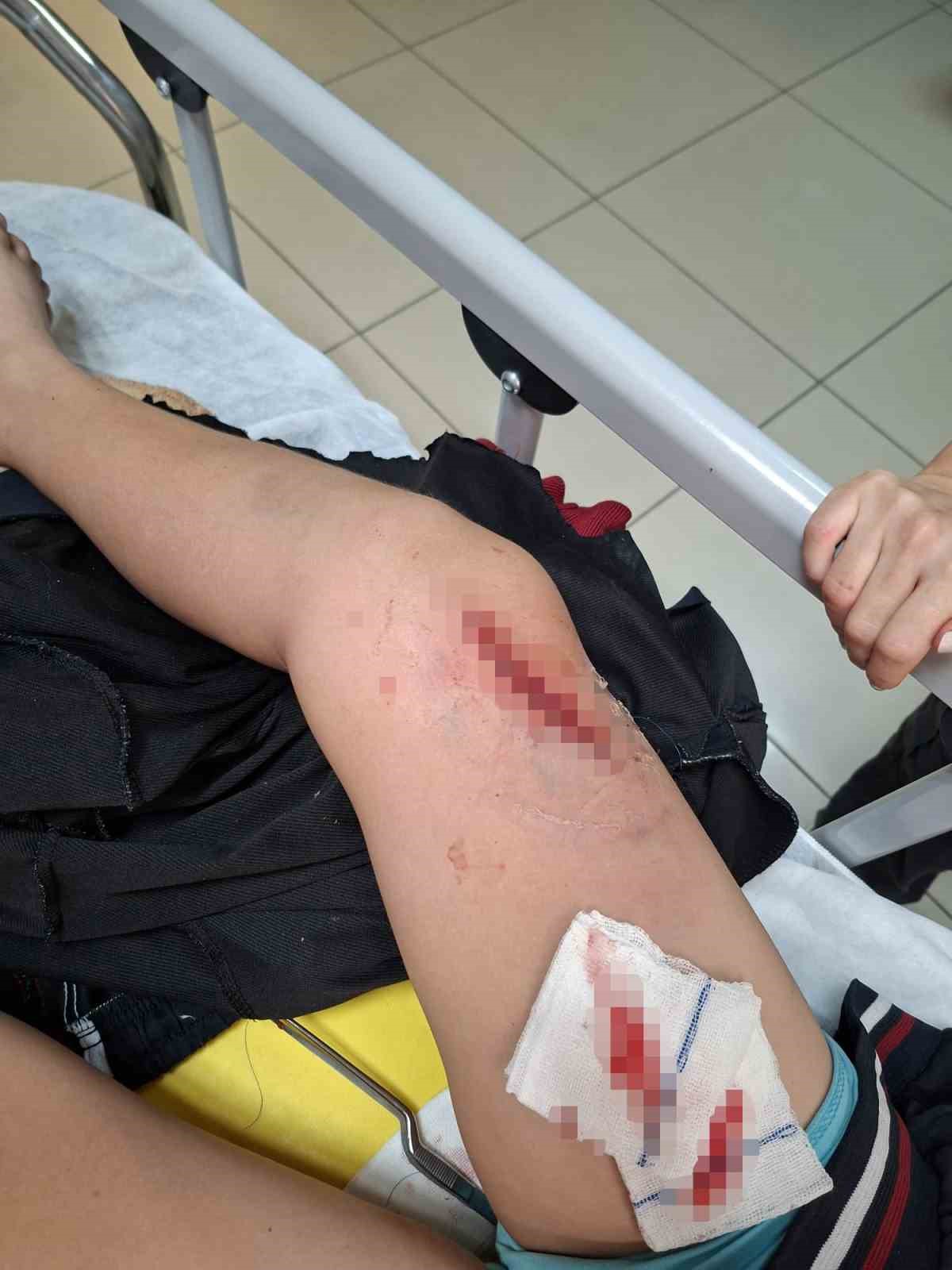 Okul bahçesinde bayrak direği öğrencilerin üzerine devrildi: 1 çocuk yaralandı
