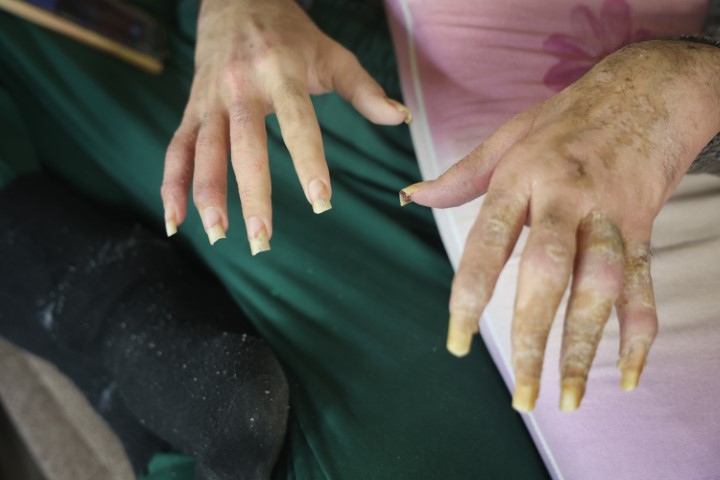 Telefon bağımlısı genç: 3 yıldır evden dışarı ne tek bir adım attı ne de beslenmek dışında bir şey yaptı