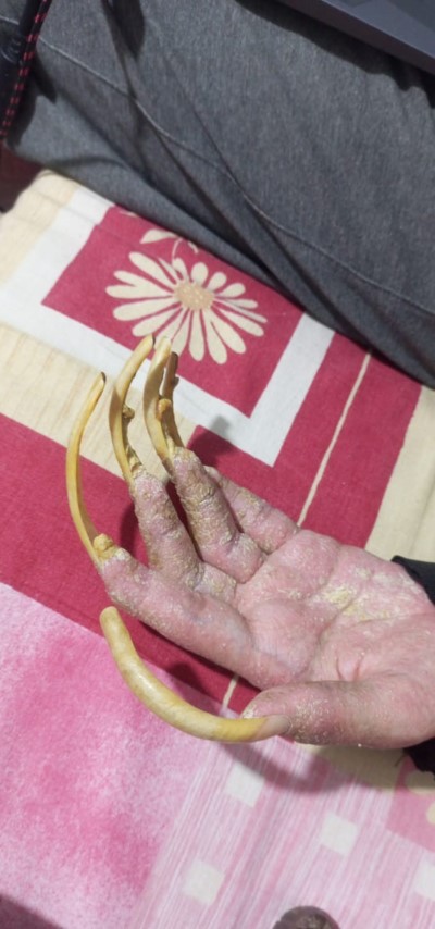 Telefon bağımlısı genç: 3 yıldır evden dışarı ne tek bir adım attı ne de beslenmek dışında bir şey yaptı