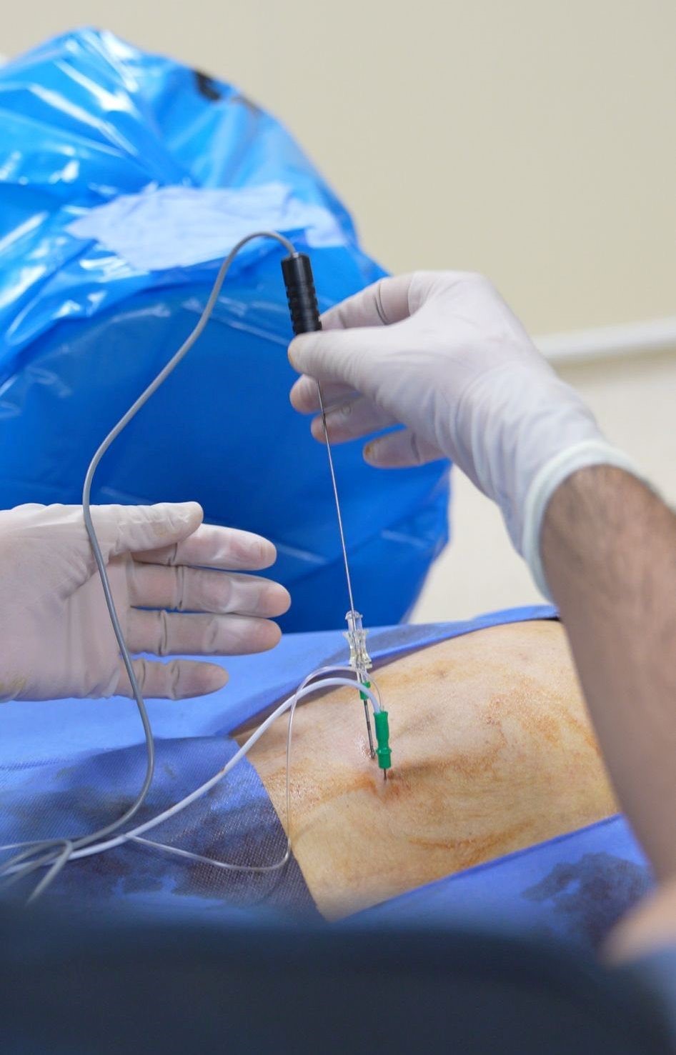 SEAH’ta bel ve boyun fıtığında ameliyatsız tedavi uygulaması başladı