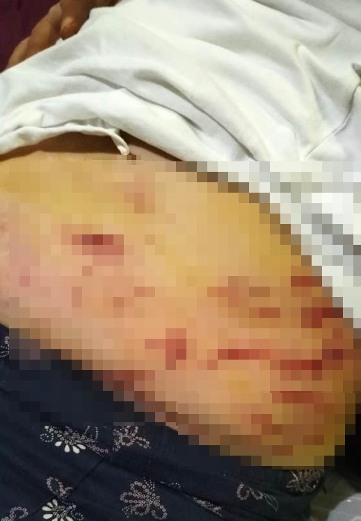 Sokakta ağızlıksız gezdirilen &rsquo;Rottweiler&rsquo; cinsi k&ouml;pek dehşet sa&ccedil;tı... O anlar kamerada
