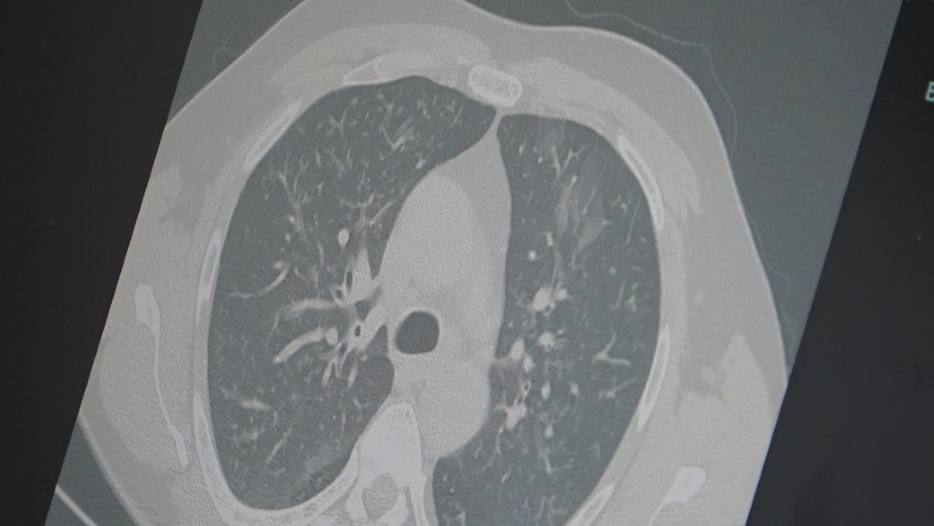 Profesör açıkladı: 