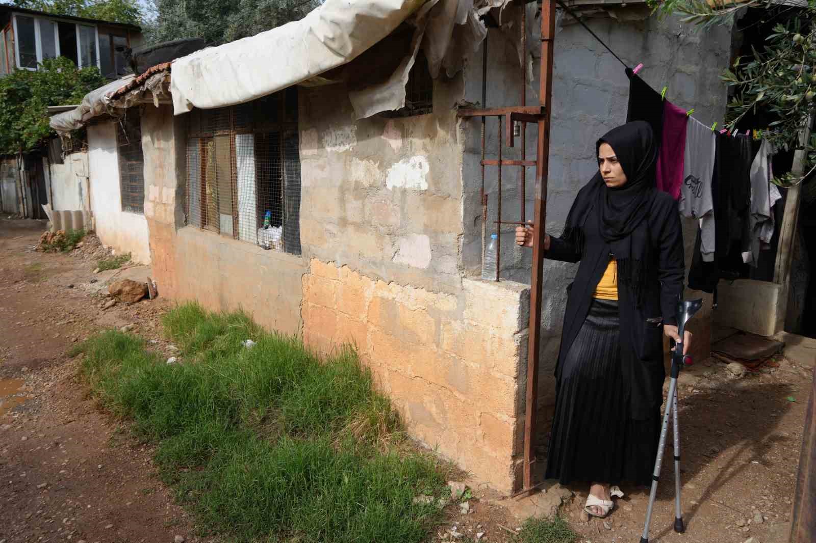Kahramanmaraş merkezli b&uuml;y&uuml;k depremde bacağını kaybetti, eşi terk etti
