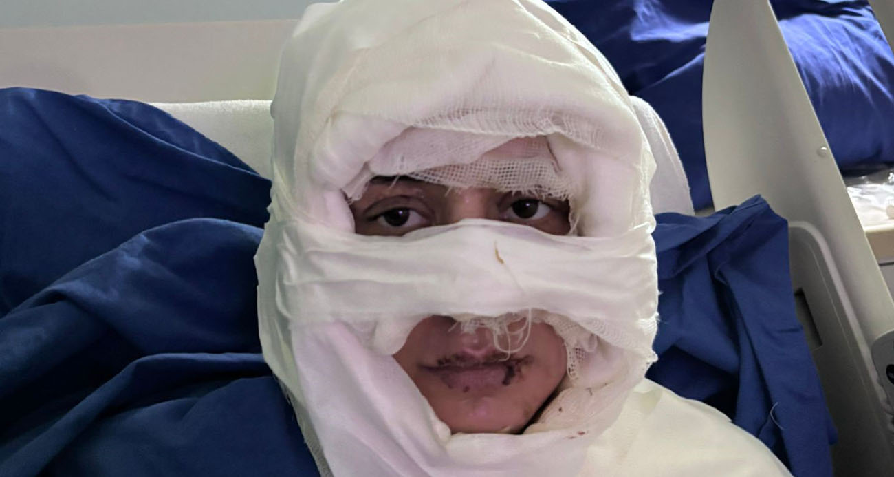 Kadıköy’de akıl almaz olay: Genç kadın başka bir kadın tarafından ateşe verildi