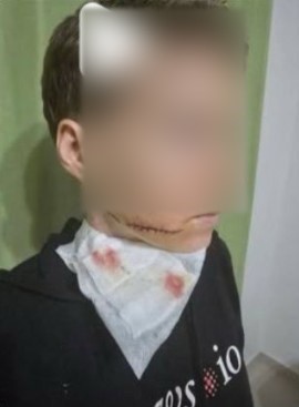 Alanya&rsquo;da sokakta kadına saldırıda bulunan şahıs yakalandı
