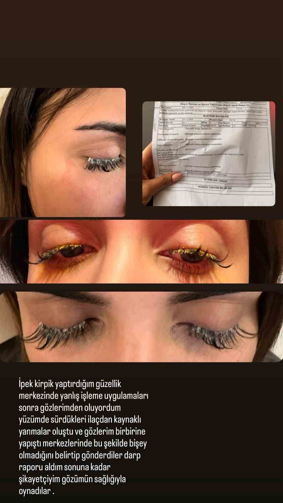 Güzellik merkezinde genç kadının gözüne yapıştırıcı kaçtı: "Kör olabilirdim"
