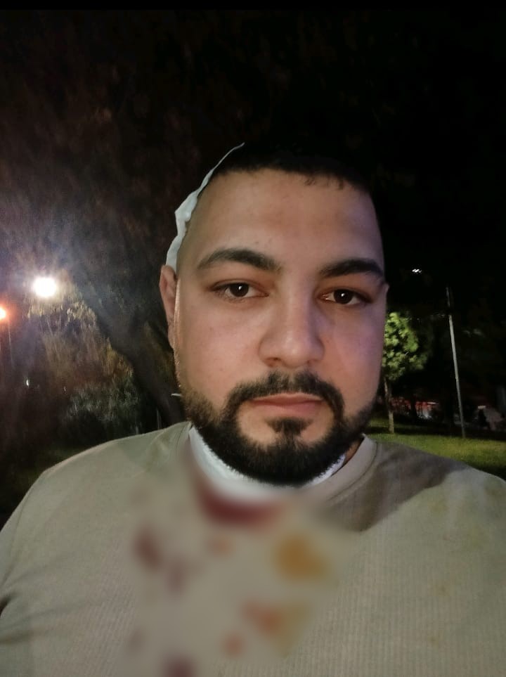 Amcası tarafından boğazından ve kafasında bıçaklanan motokurye: "Kendisi serbest, can güvenliğim yok"