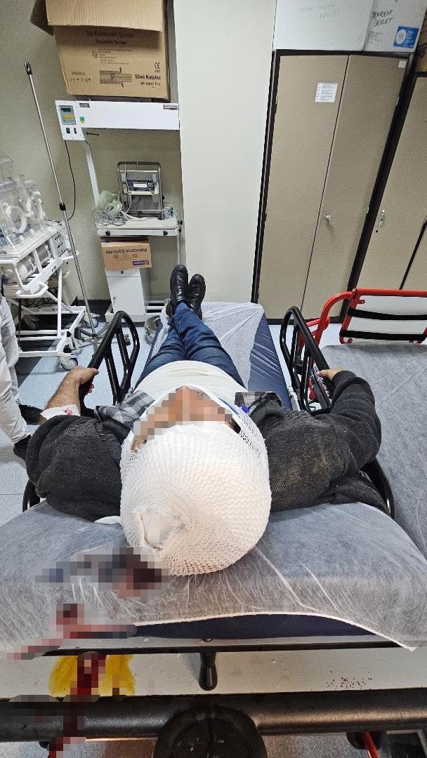 Sakarya’da merdivenden düşen şahıs yaralandı