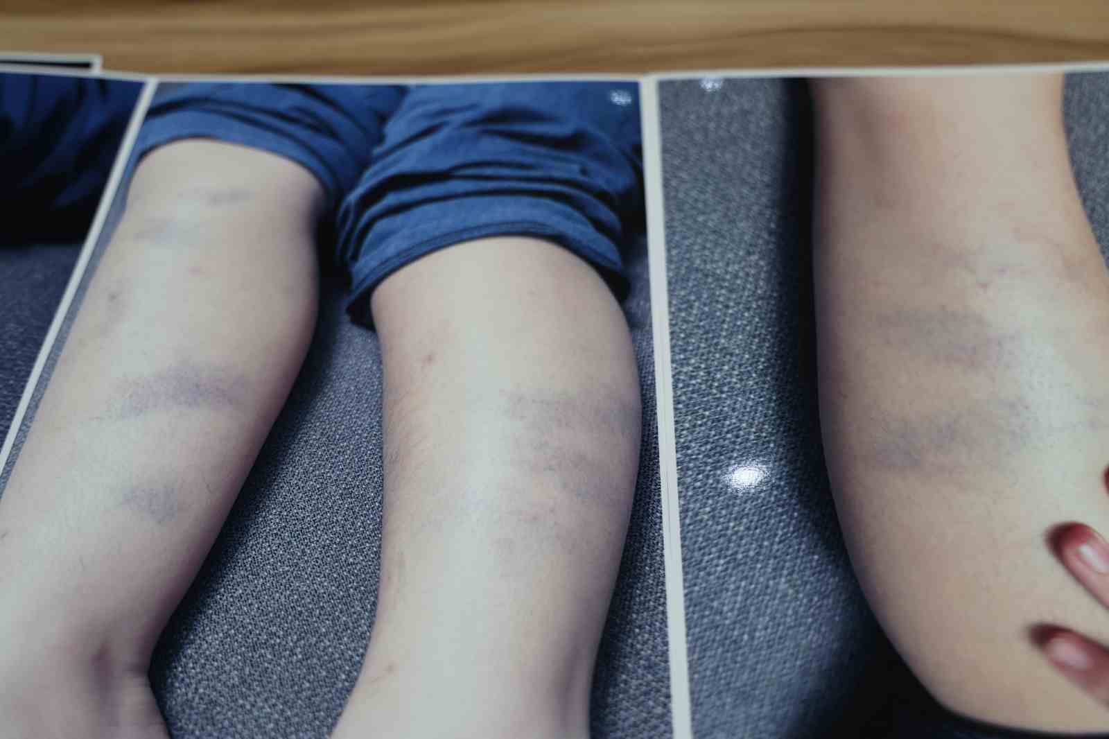 Diyarbakır&rsquo;da &ouml;zel okulda 8 yaşındaki &ccedil;ocuğun darbedildiği iddiası
