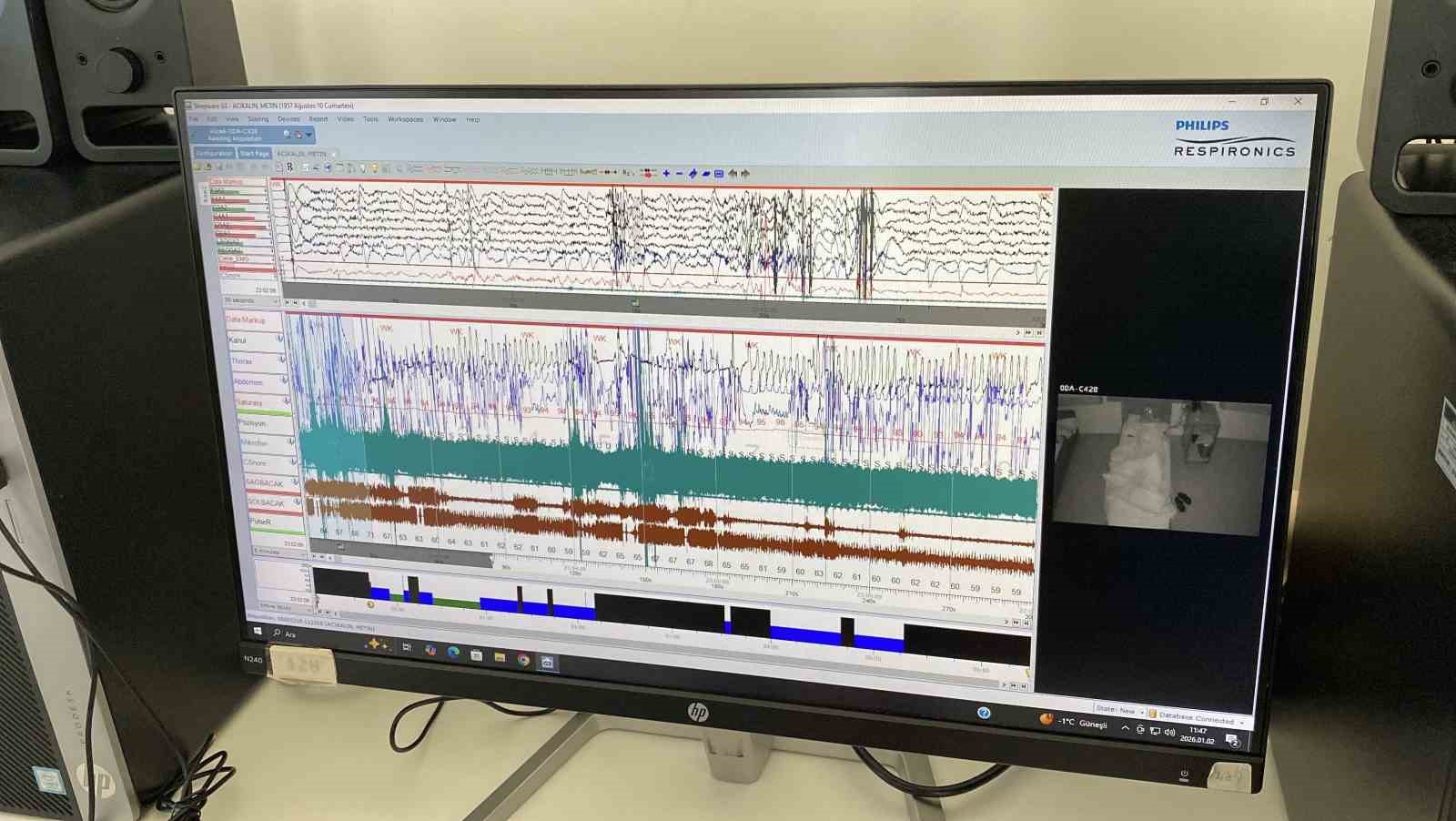 Eskişehir Şehir Hastanesi&rsquo;nde n&ouml;roloji hastalarına ileri tedavi imkanları sunuluyor
