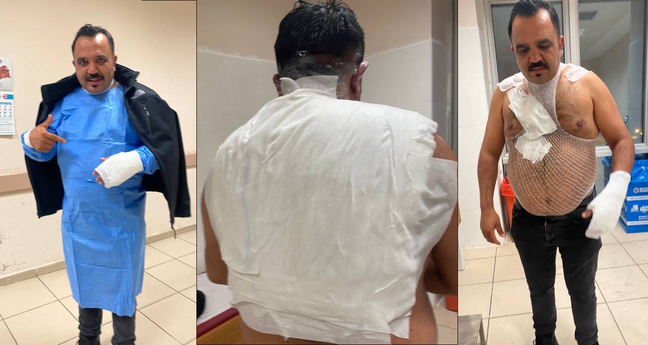 Meşhur tost&ccedil;u, soğuk havada şov yapmak isterken kendini yaktı