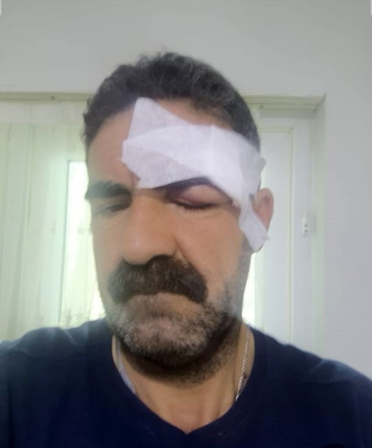 Elazığ&rsquo;daki kavga, tuvaletini duvara yapan yolcu nedeniyle &ccedil;ıkmış
