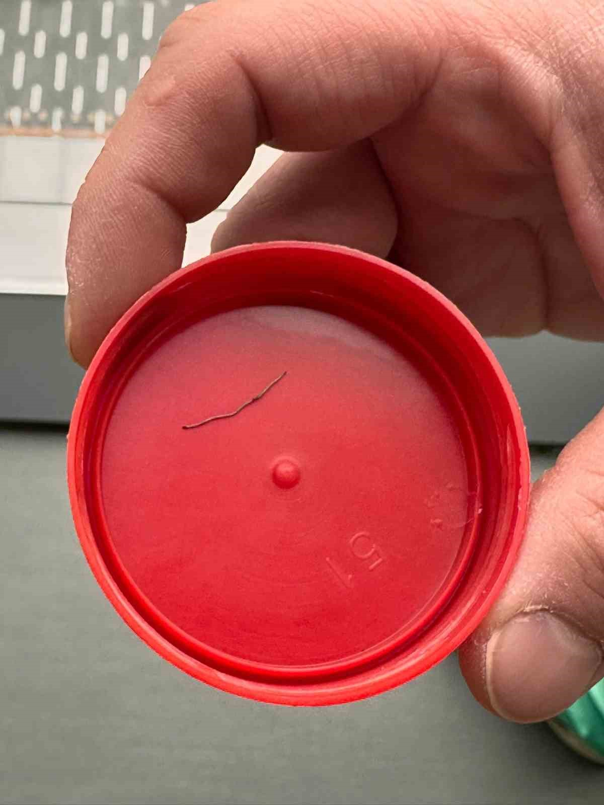 Bebeğin sırtından tel par&ccedil;ası &ccedil;ıktı
