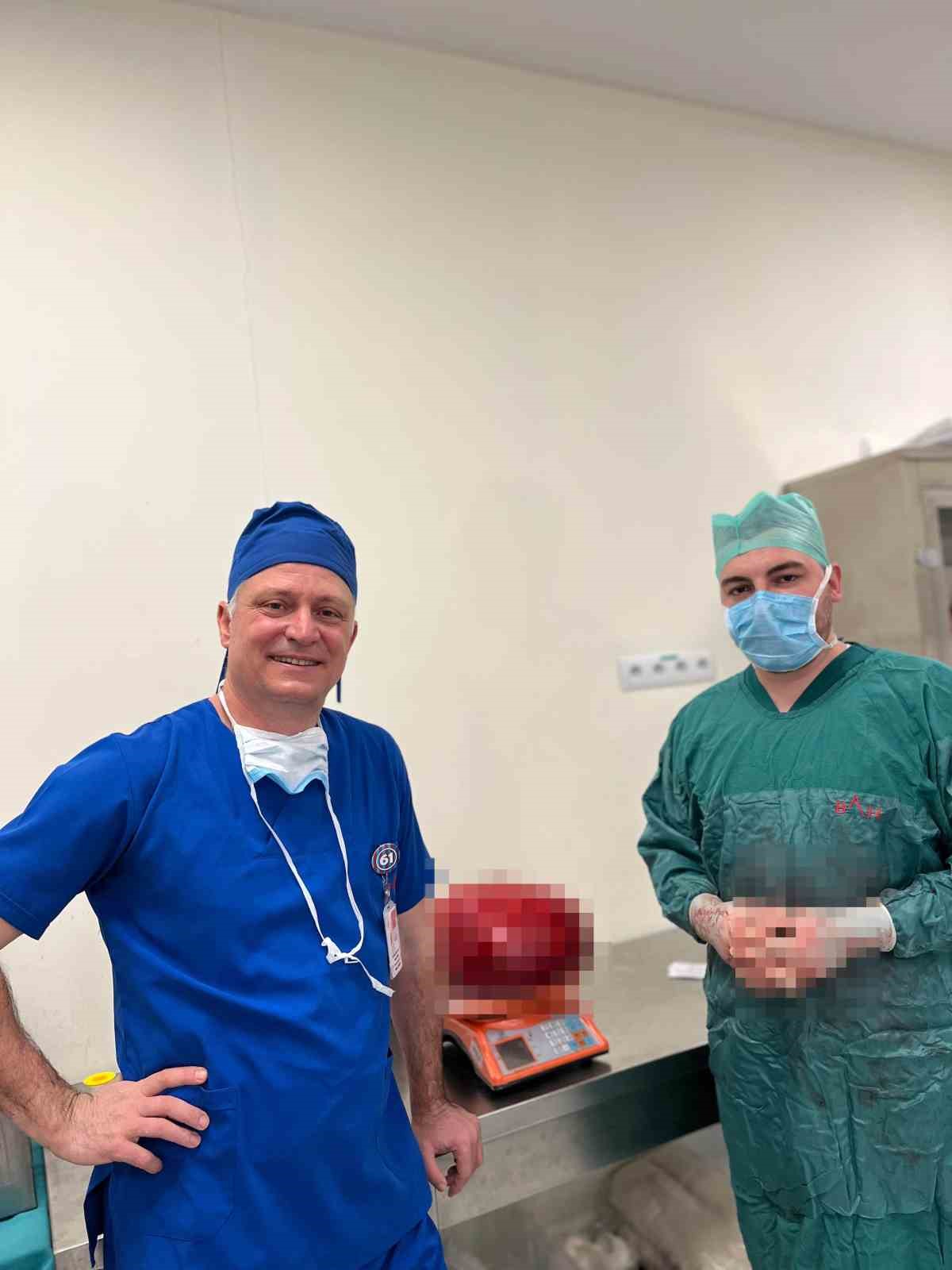 G&ouml;renler kilo aldı sandı, karnından 30 santim uzunluğunda 10,5 kiloluk kitle &ccedil;ıktı
