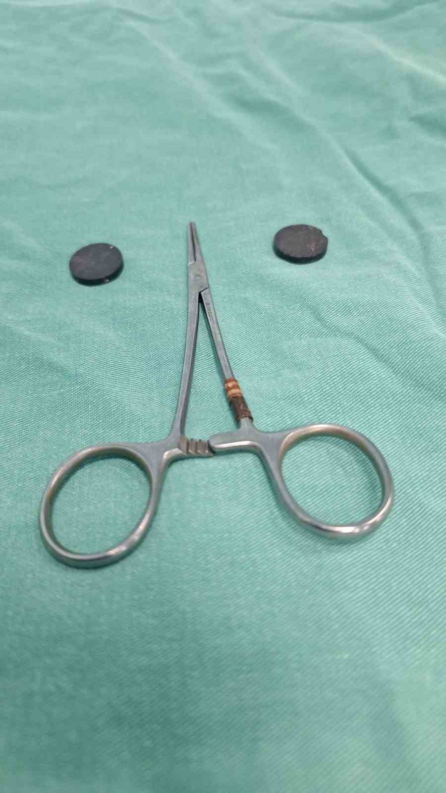 Mıknatıs yutan &ccedil;ocuk, ameliyatla sağlığına kavuştu
