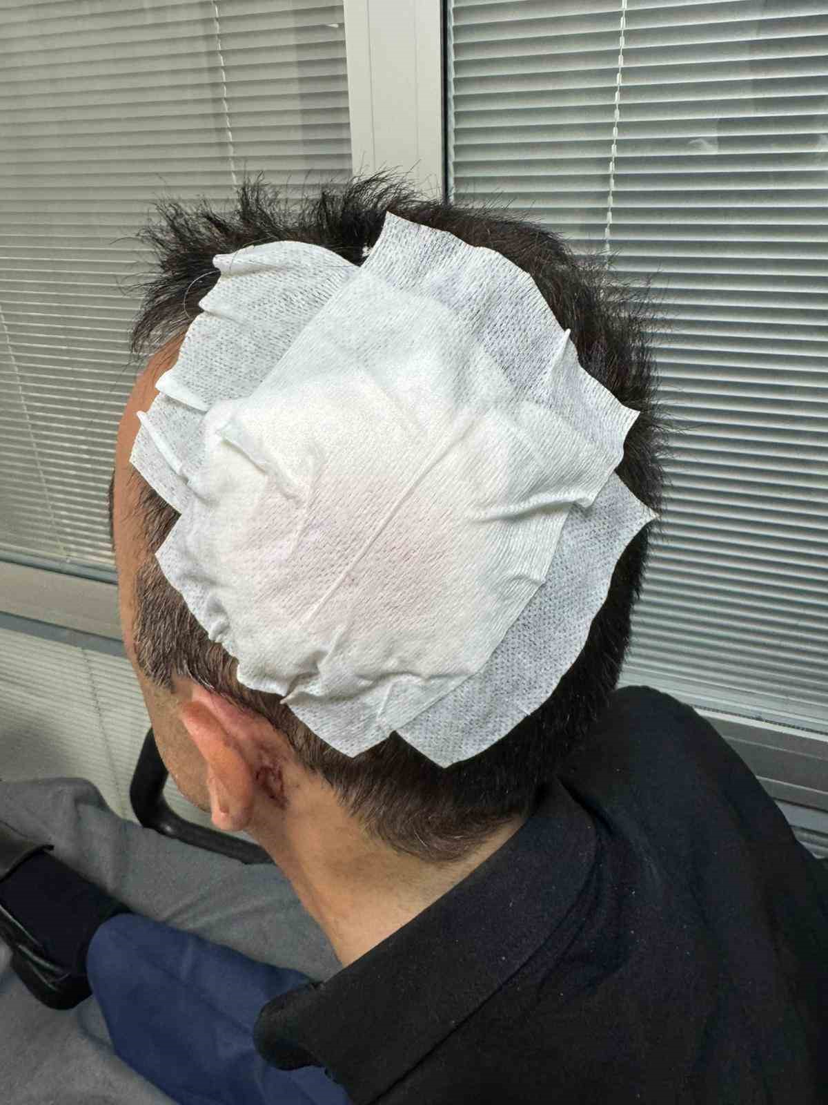 Bayburt’ta engelli vatandaşa çarpıp kaçan sürücüye 15 bin lira ceza: "Vicdanlarımız ikinci kez yaralandı"