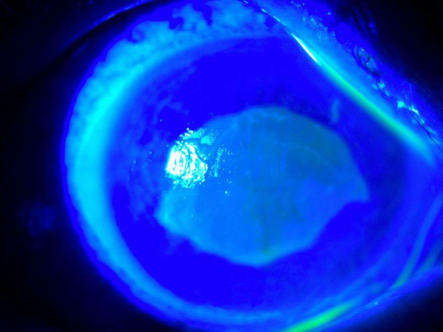 &rsquo;Kırlangı&ccedil; otu kullanımı&rsquo;na dikkat, uzmanlar uyarıyor: 