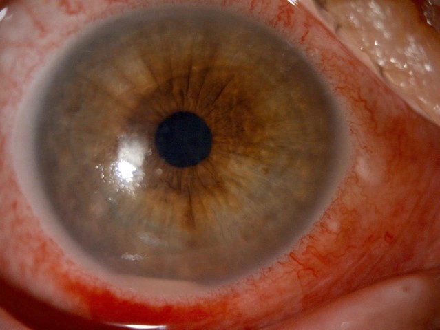 &rsquo;Kırlangı&ccedil; otu kullanımı&rsquo;na dikkat, uzmanlar uyarıyor: 