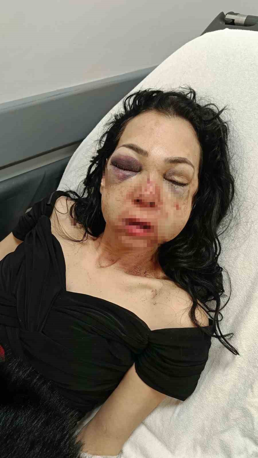 Anne ve oğlunu &ouml;ld&uuml;resiye darp eden ş&uuml;pheliler: "Merdivenlerden d&uuml;şt&uuml;"
