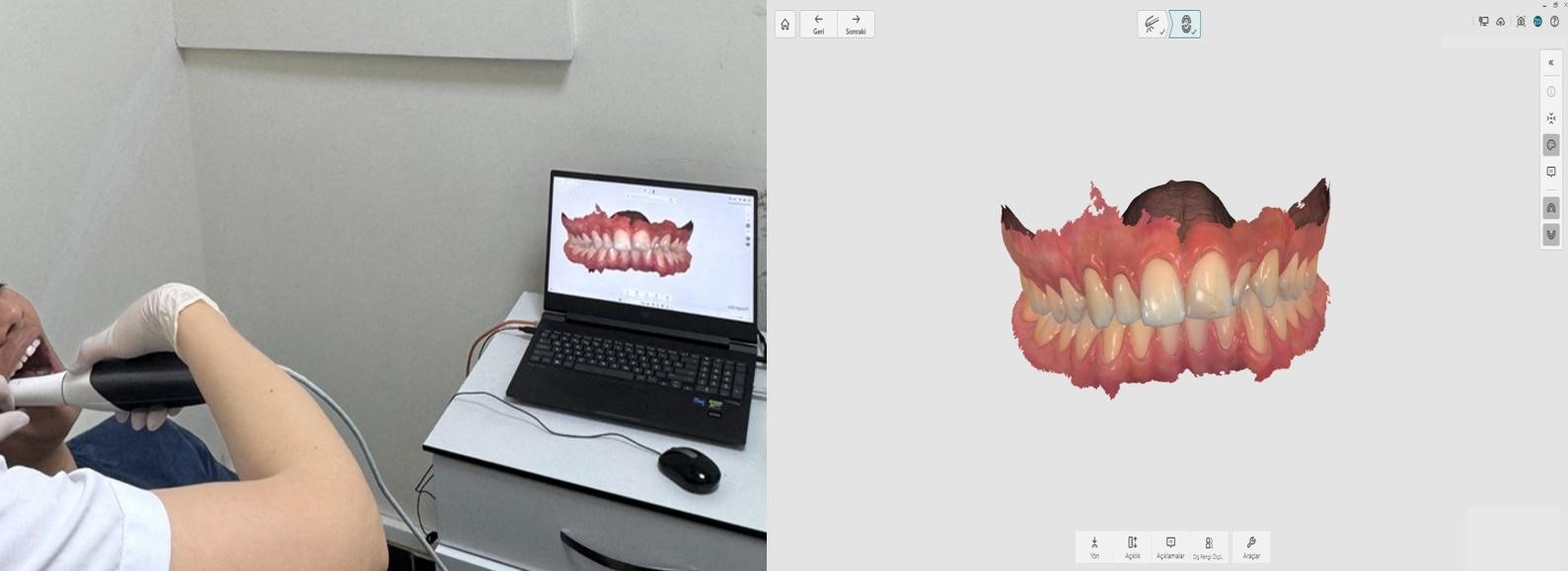 Zonguldak&rsquo;ta Modern Ortodontik Tedavi D&ouml;n&uuml;ş&uuml;m&uuml;: BEUN B&ouml;lgeye Hizmet Sunuyor
