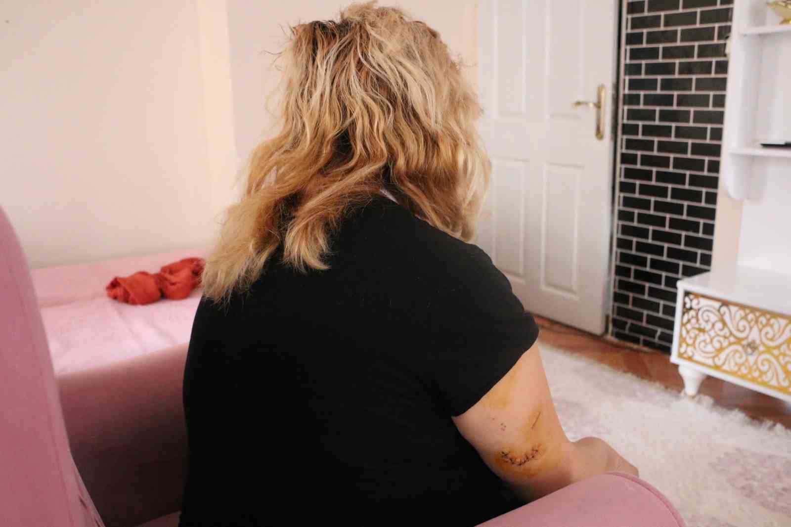 Diyarbakır&rsquo;da dehşet: Nikahlı eşini 30 yerinden bı&ccedil;akladı
