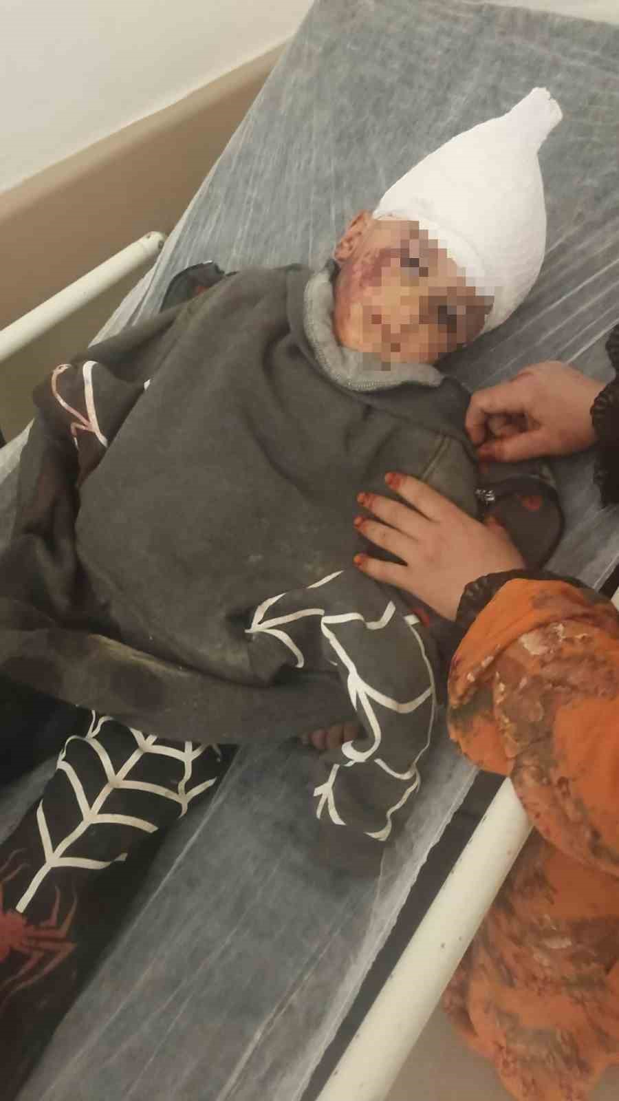 K&ouml;pek saldırısında yaralanan 3 yaşındaki bebek 34 g&uuml;n sonra evine kavuştu
