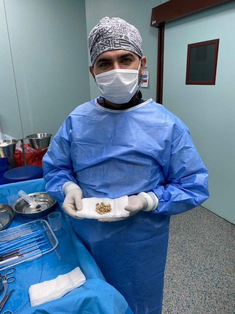 Bing&ouml;l&rsquo;de PNL y&ouml;ntemiyle b&ouml;brek taşı tedavisinde sevkler azaldı
