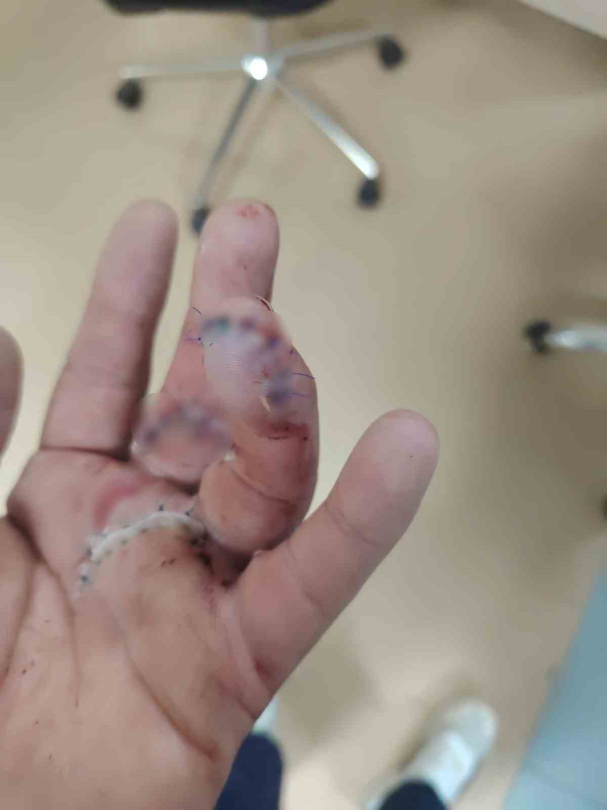Motokuryeye döner bıçaklı saldırı iddiası