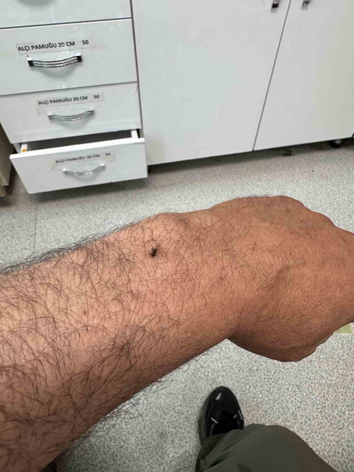 İtfaiye erinin koluna yapışan kene hastanede çıkarıldı