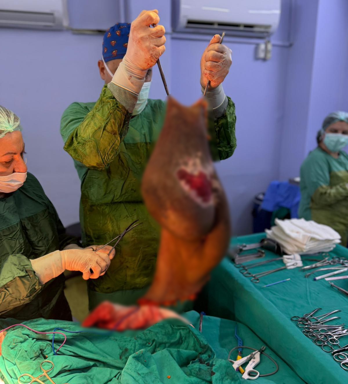 Karnından 40 kilogram kitle çıkarıldı
