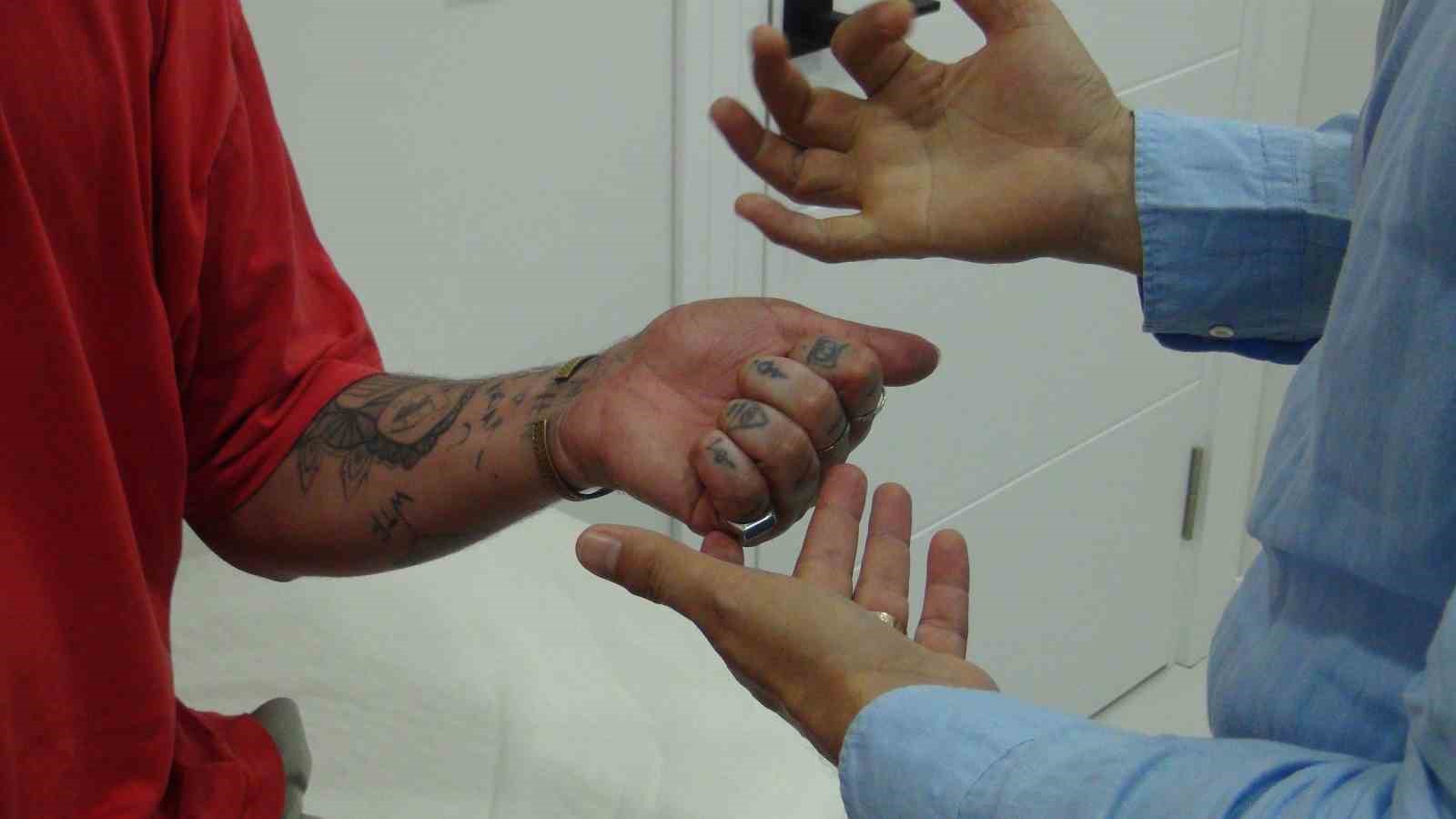 Bileği koptu, doktoru sayesinde hayattan kopmadı