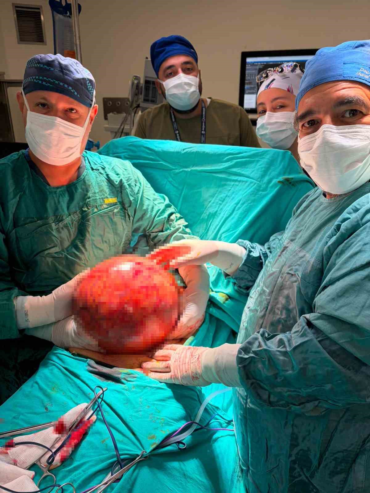 Doktorlar gözlerine inanamadı: 1,5 yıl ertelediği ameliyatta karnından dev kitle çıktı