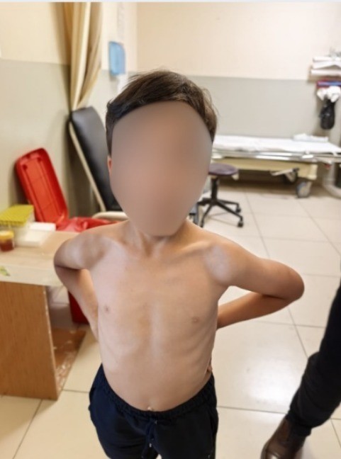 İnegöl’de kene alarmı